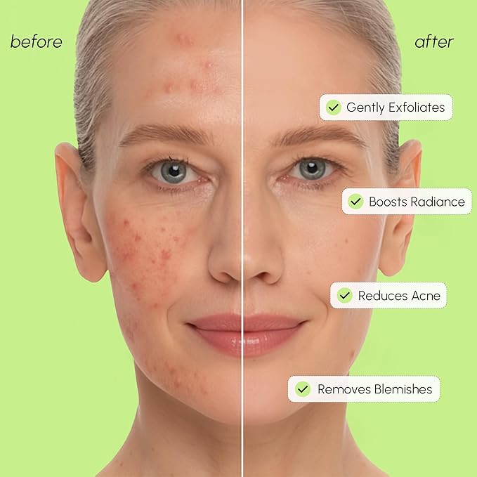 MAREE Exfoliating Toner with Salicylic Acid – AHA BHA Face Exfoliant & Pore Cleaner – BHA Liquid Exfoliant for Sebum & Dead Skin Care Remover – Face Exfoliator – Acido Salicilico Exfoliante Facial