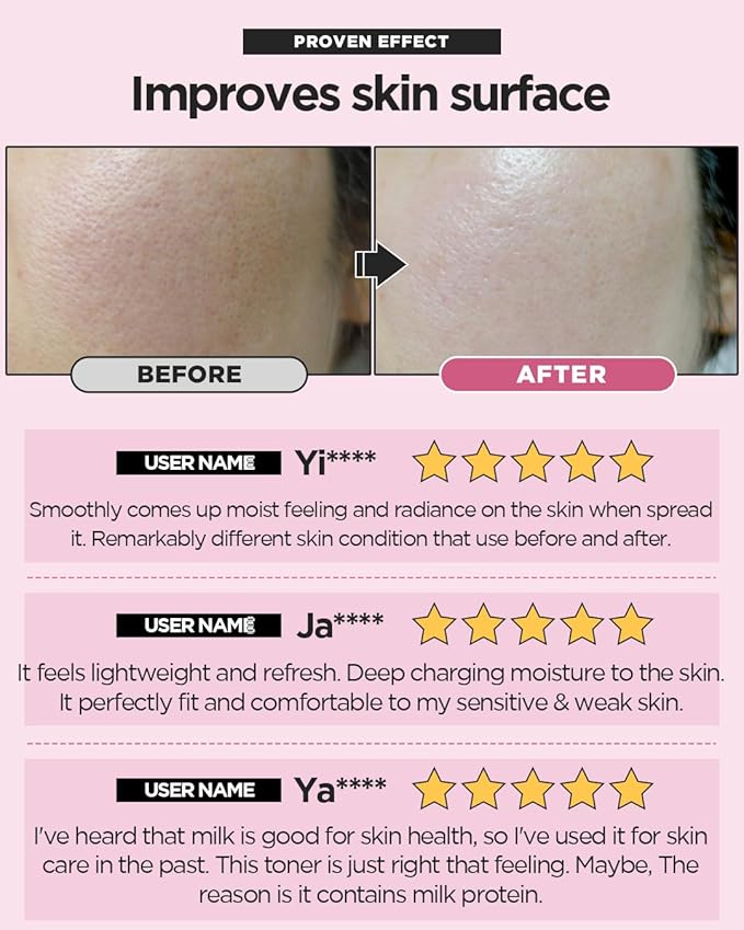 SKINRxLAB MadeCera Cream Double Essence Korean Toner 150ml (5.07fl.oz.) - Hydrating and Soothing with Milk Protein, Ceramide, Beta-Glucan - Moisturizing Strawberry Milky Toner for Irritated Skin