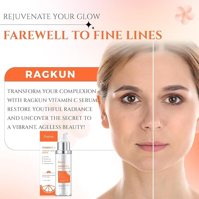 20% Super Vitamin C Retinol Serum for Face, Dark Spot Remover for Face, CE Ferulic Acid, Hyaluronic Acid, Hydrate & Plump Skin Care Anti Aging Wrinkle Brightening Skincare -1 Fl Oz.