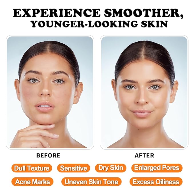 Vitamin C Serum for Face with Vitamin E & Ferulic Acid, Smoothes Wrinkles,Improves Elasticity,Firms Skin 1 Oz for Face Care, Daily Use