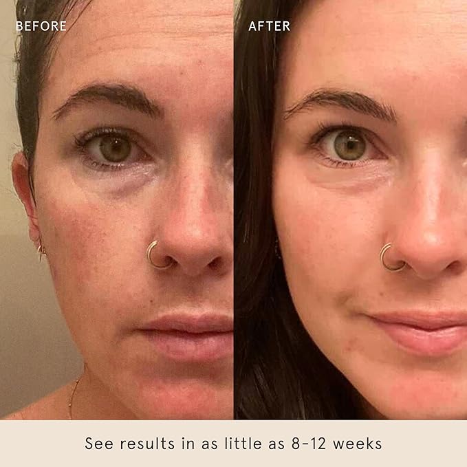 Barefaced Serum Trio - Liquid Gold, Overachiever, RetinAL - Powerful Ingredients for Healthier, Smoother Skin