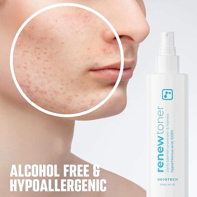 BRIOTECH Renew Toner, Hypochlorous Acid Spray, Minimize Appearance of Blemishes, Soothing Facial Mist for Sensitive Skin, Calm Redness & Bumps, Vegan, 4 fl oz