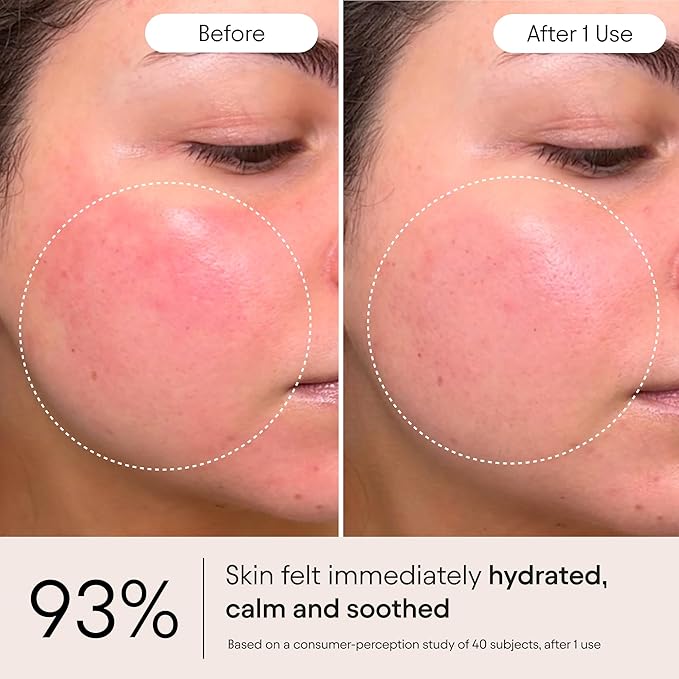 Alpyn Super Peptide & Ghostberry Moisturizer for Eczema, Barrier & Wrinkle Repair | Calm & Soothe Against Redness & Irritation | 1.7 oz / 50 ml