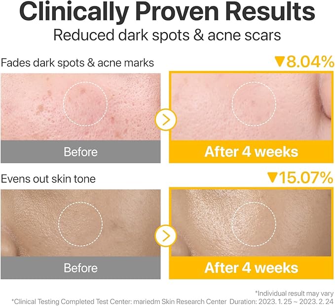 numbuzin No.5 Toner Pads | Vitamin-Niacinamide Concentrated Pad | Double-Sided | Glutathione, Niacinamide, PHA & LHA | Exfoliation, Hyperpigmentation Care | 70 Pads/180 ml