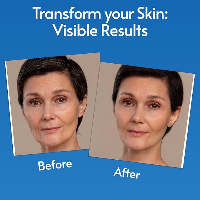 Sylk Hyaluronic Acid Serum for Face - Ultra Hydrating Anti Aging & Anti Wrinkle Serum with Vitamin C & E - Moisturizing & Plumping Formula for Smooth Skin - Microneedling - Korean Skincare - 2 fl oz