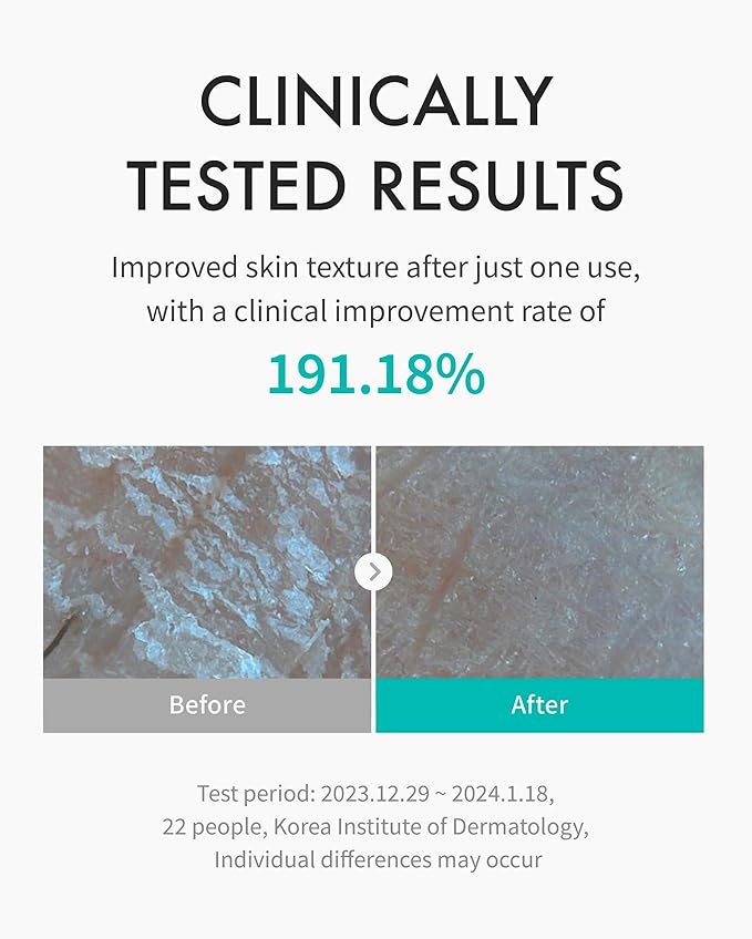 REJURAN® Moisture Treatment Toner, c-PDRN® - Hydrating Facial Toner for Enhanced Skin Barrier Strength, Soothing, and Moisture Retention with PDRx, Korean Skin Care (5.07 fl oz)