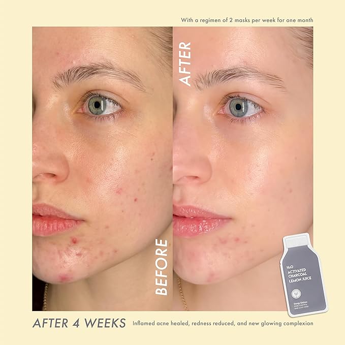 ESW Beauty Deep Detox - Pore Control Raw Juice Face Mask - Clarifying with Activated Charcoal, Lemon Juice & H2O for Acne-Prone Skin - Detoxifies & Minimizes Pores