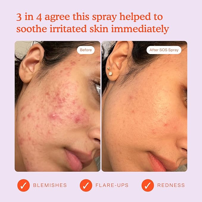 Tower 28 Beauty SOS Daily Rescue Facial Spray Jumbo Refill 16 oz / 480 mL