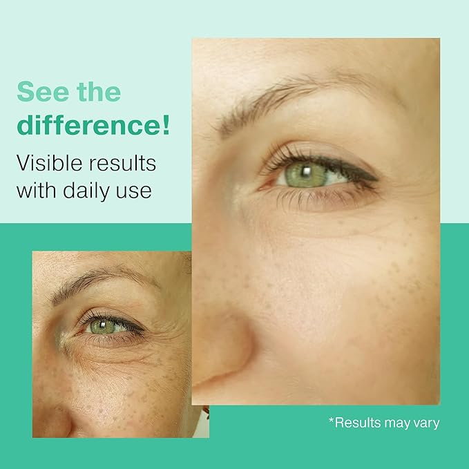 2X Bigger 2oz Glycolic Acid Exfoliant, 5% AHA BHA Serum with Salicylic & Lactic Acid for Acne-Prone Skin, Gentle Peel for Oil Control & Pore Refining