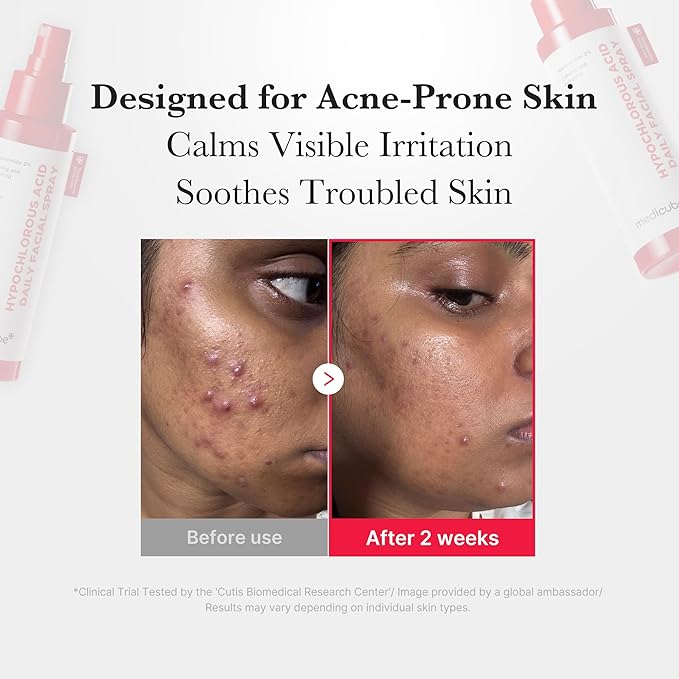 medicube Power Soothing Spray, Hypochlorous Acid Spray For All Skin Types, Delicate Skin Daily Solution & Post-Sun Care, HOCI Facial Mist for Soothing & Calming , Korean Skincare, 4.22 fl.oz