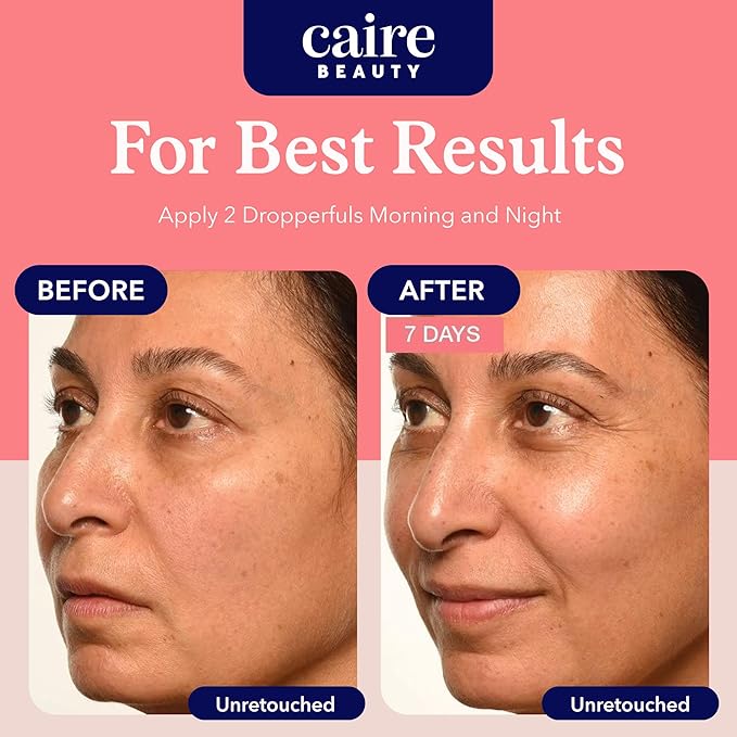 Caire ‘Own Your Age’ Hyaluronic Acid Peptide Deep Infusing Serum for Face, Eyes + Neck | Wrinkle Fighting, Collagen Generation for Women Over 40 | 30ml