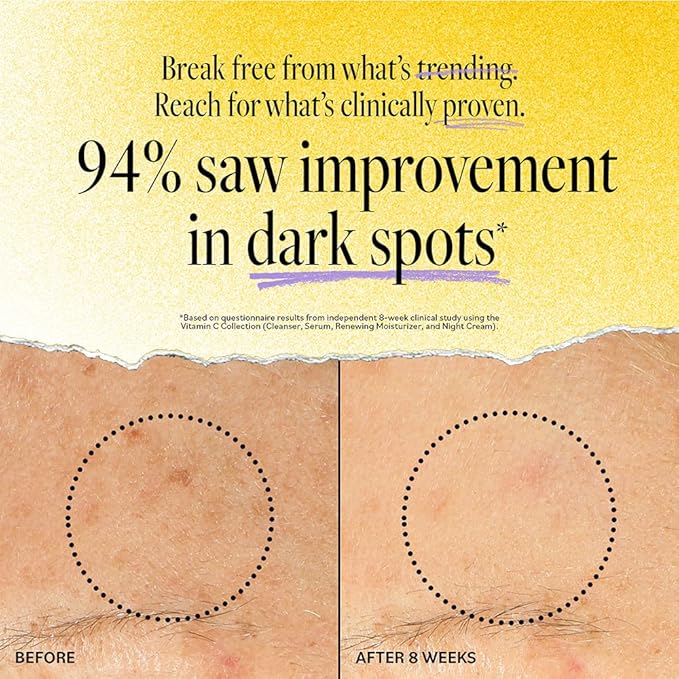 DERMA E Vitamin C Concentrated Serum, 2 Oz, with Hyaluronic Acid, Vitamin E & Aloe, All Natural, Antioxidant-Rich Concentrated Formula, Hydrating & Brightening Vitamin C Face Serum