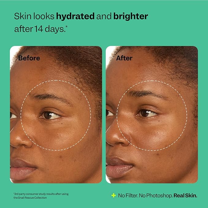 Peach Slices Snail Rescue All-In-One Deep Moisture Cream