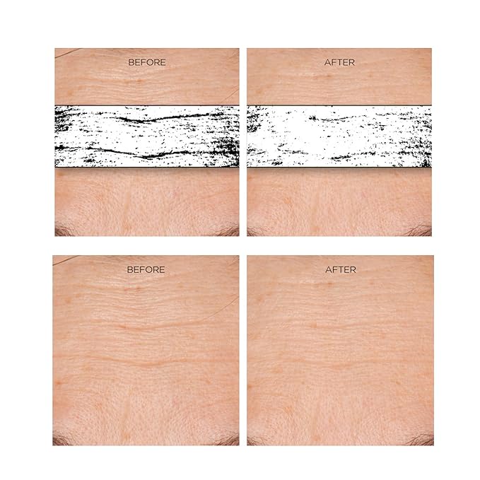 Erasa XEP 30 Rejuvenation Serum for Line Lifting and Crow's Feet