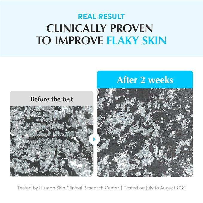 EQQUALBERRY Swimming Pool Toner - Korean Toner for Daily Exfoliating & Deep Hydration with Natural Enzyme Protease & Hyaluronic Acid, For Sensitive Skin, 10.14 Fl Oz (300ml)