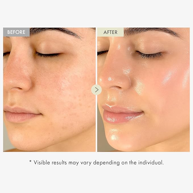 TOSOWOONG Real Collagen Face Serum, Hydrating & Firming Serum with hydrolyzed collagen, Hyaluronic Acid, Plumps, Sagging Skin, Reduces Fine Lines and Wrinkles, Korean Skincare, 33ml / 1.11 fl. oz.