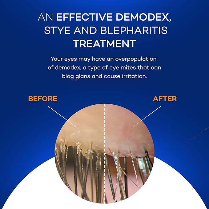 Zocular - Zocuwipe Eyelid Wipes with Natural Okra Complex - Eyelid Cleanser and Moisturizer Pads - Eyelid Cleansing Wipes - Blepharitis Treatment - 40ct