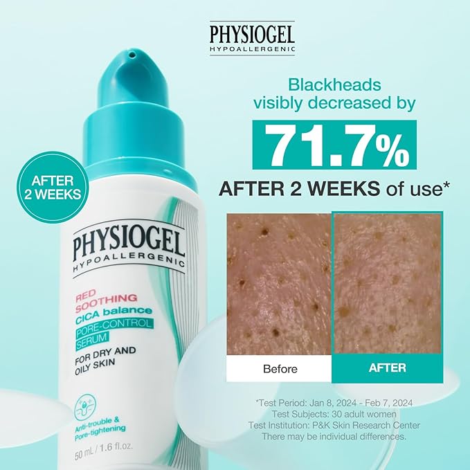 Physiogel Red Soothing CICA Balance Pore-Control Serum, Niacinamide Facial Exfoliant for Blackheads, Pore Minimizer Serum for Face, Korean skin care, 1.69 fl.oz