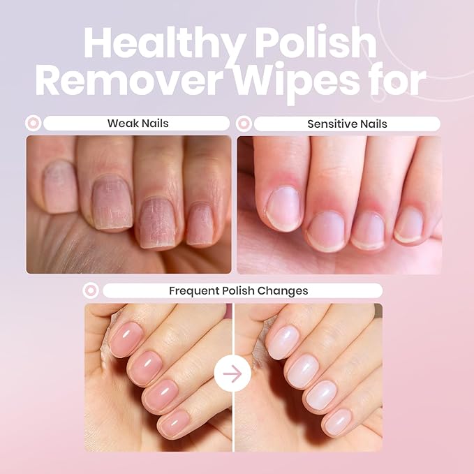 Beetles Non Acetone Nail Polish Remover - 8.45Fl Oz/250ML Nourishing Formula Acetone Free Nail Polish Remover - Non-Drying - Professional Quick and Gentle Removal for Natural Damaged Nails