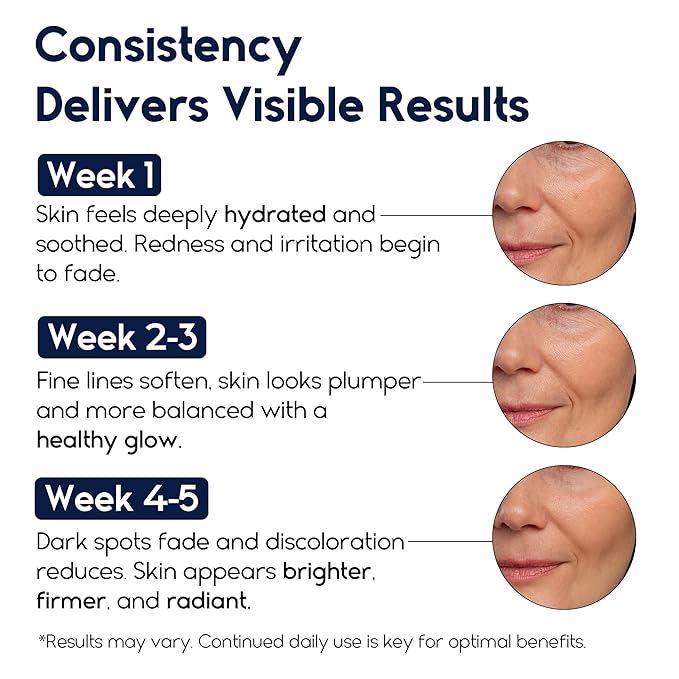 Hyaluronic Acid Serum for Face – 2.5% Hyaluronic Acid + 3% B5 - Acido Hialuronico B5 Serum for Women - Hydrating Formula for Fine Lines, Wrinkles & Anti Aging - 30ml