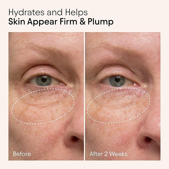 Alpyn Wild Nettle & Niacinamide Firming Serum | Visibly Smooth, Plump, & Moisturize | Reduce the Look of Fine Lines & Pores - For All Skin Types | 1 oz / 30 ml