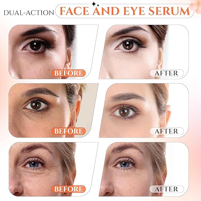 20% Super Vitamin C Retinol Serum for Face, Dark Spot Remover for Face, CE Ferulic Acid, Hyaluronic Acid, Hydrate & Plump Skin Care Anti Aging Wrinkle Brightening Skincare -1 Fl Oz.