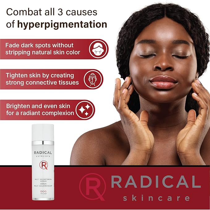 Radical Skincare Multi Brightening Serum - Fights 7 Causes of Uneven Skin Tone, Tightens & Brightens Skin - For All Skin Types Including Sensitive Skin - Paraben & Cruelty Free (1 oz)