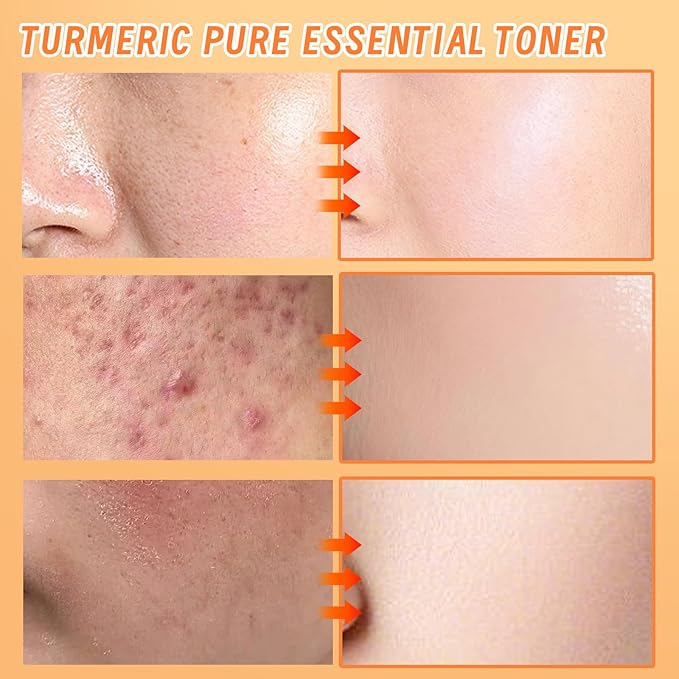 Face Toner for Women, Turmeric Facial Toner, Skin Toner for Even Skin Tone, Soothing, Moisturizing, Reduce Fine Lines, Suitable for All Skin Types, 4.06fl.oz/120ml