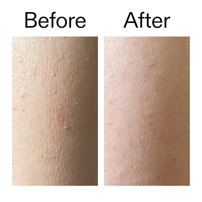 The INKEY List Glycolic Acid Exfoliating Body Stick 45g, Multiple Concerns, One Targeted Solution, Delivers Deep, Effective Exfoliation, Fragrance Free, Suitable For All Skin Types