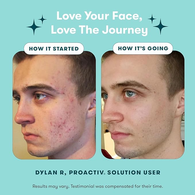 Proactiv 3 Step Acne Treatment w/ Pimple Patches - Benzoyl Peroxide Face Wash, Repairing Acne Spot Treatment for Face and Body, Exfoliating Toner - 90 Day Complete Acne Skin Care Kit + Pimple Patches