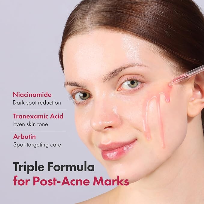 TOSOWOONG Niacinamide 10% + Tranexamic Acid 4% Serum, Arbutin 2%, Hyaluronic Acid, TXA Facial Serum, Glass Skin, Clarifying, Radiant Complexion with Natural Color, Korean Skin care, 33ml, 1.11 fl.oz.