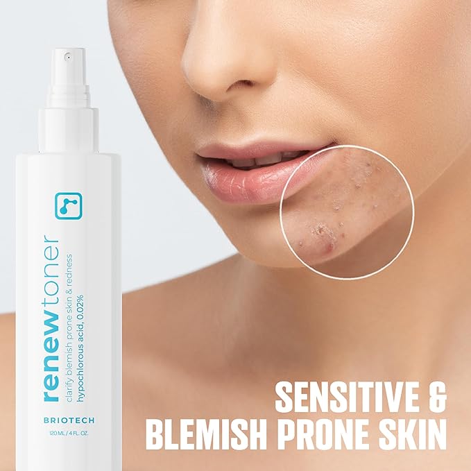 BRIOTECH Renew Toner, Hypochlorous Acid Spray, Minimize Appearance of Blemishes, Soothing Facial Mist for Sensitive Skin, Calm Redness & Bumps, Vegan, 4 fl oz