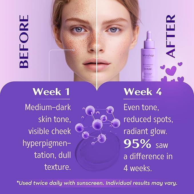 Skin Pigmentation Corrector Serum, Niacinamide and Peptide MAX, 1.69 fl oz, Dark Spot Treatment