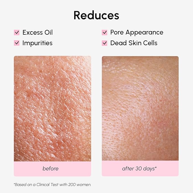 MAREE Pore Minimizer for Face Toner – Witch Hazel Toner with Niacinamide & Marine Collagen – Gentle Exfoliating Oil Control Facial Toner for Women – BHA Liquid Exfoliant – Alcohol Free Tonico Facial