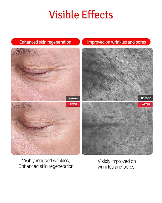 VITABRID C12 Wrinkle Cream - Age Defying Skin Recovery Moisturizer with Peptides, Vitamin C, Shea Butter - Wrinkle Repair Moisturizing Day & Night Skincare for Face and Neck - Fragrance Free, 1.69oz.