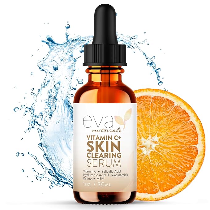 Vitamin C Serum for Face with Retinol & Salicylic Acid – Skin Clearing Acne Spot Treatment with Niacinamide, Hyaluronic Acid, MSM – Anti-Aging Facial Serum for Dark Spots and Blemishes