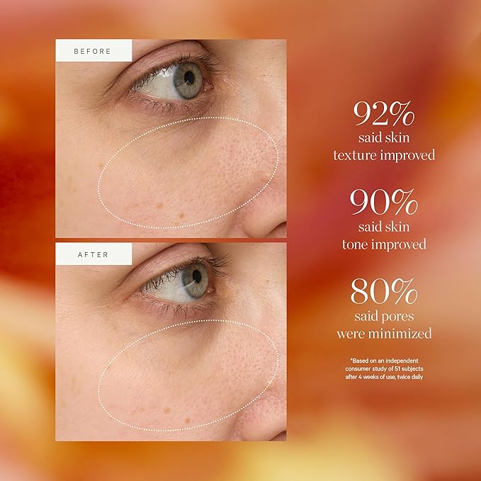 KORA Organics Turmeric Glow Drops, Niacinamide Alternative Face Serum for Radiance, Texture and Pore Appearance, Certified Organic, Vegan, 1.01 fl oz