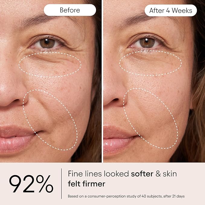 Alpyn Super Peptide & Ghostberry Moisturizer for Eczema, Barrier & Wrinkle Repair | Calm & Soothe Against Redness & Irritation | 1.7 oz / 50 ml