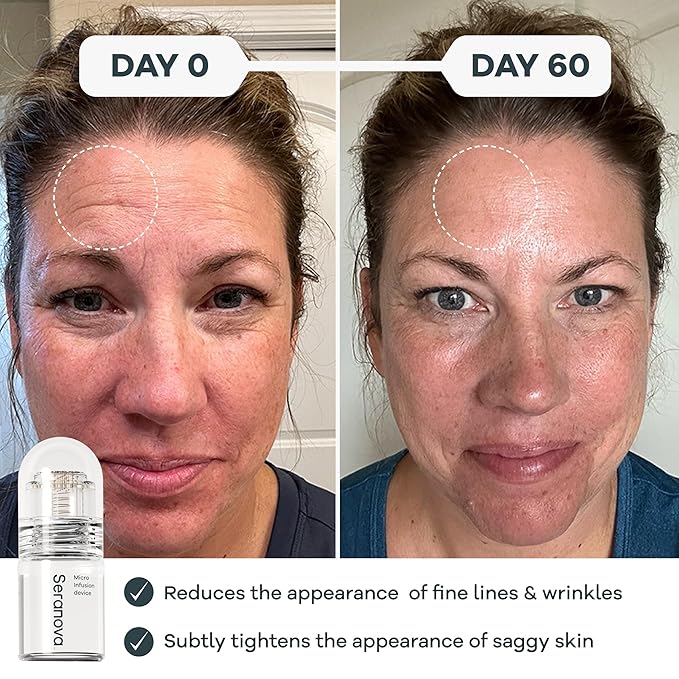 Seranova Micro Infusion System for Face & Neck 0.05mm Stamp with Hyaluronic Acid & Collagen Peptide Serum for Firmer Smoother-Looking Skin, Easy 5-Minute At-Home Skin Care Application - 3 Month Supply
