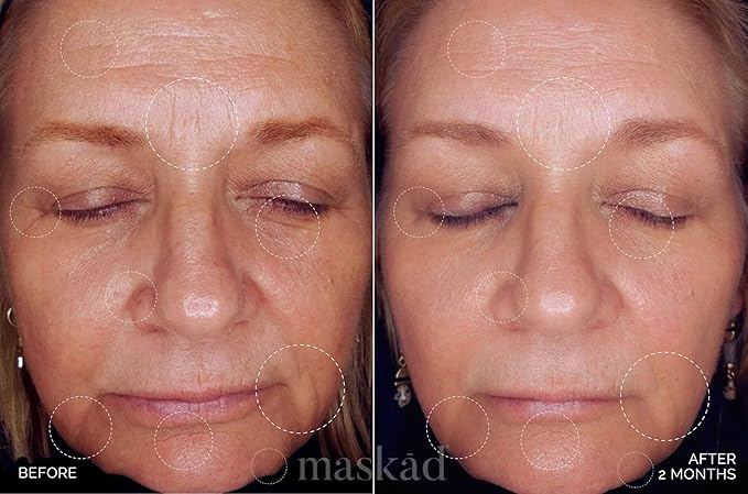 MASKĀD® Advanced Anti-Aging Multi-Peptide Enriched Facial Serum, Peptide Serum to Support Skin Appearance, Fine Lines, & Hydration, Collagen-Focused Care, Clean, Gentle Skin Care, Extra Large 2oz